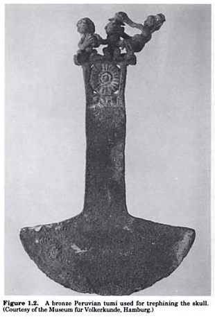 Eina bronze precolombina trepanacions cranials